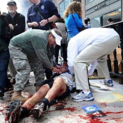 Mais de 10 pessoas sofreram amputações pelos ferimentos causados pelo duplo atentado na Maratona de Boston