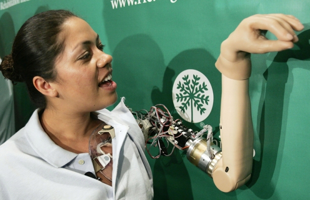 First "Bionic Woman" Demonstrates Thought-Controlled Prostheses