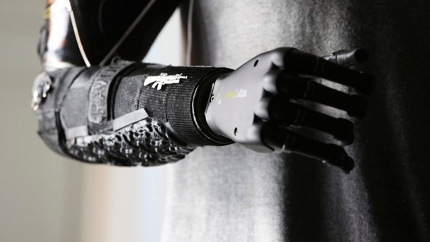 Britânico nascido sem mão obtém braço biônico inspirado em jogo eletrônico  - HOSPITAIS BRASIL